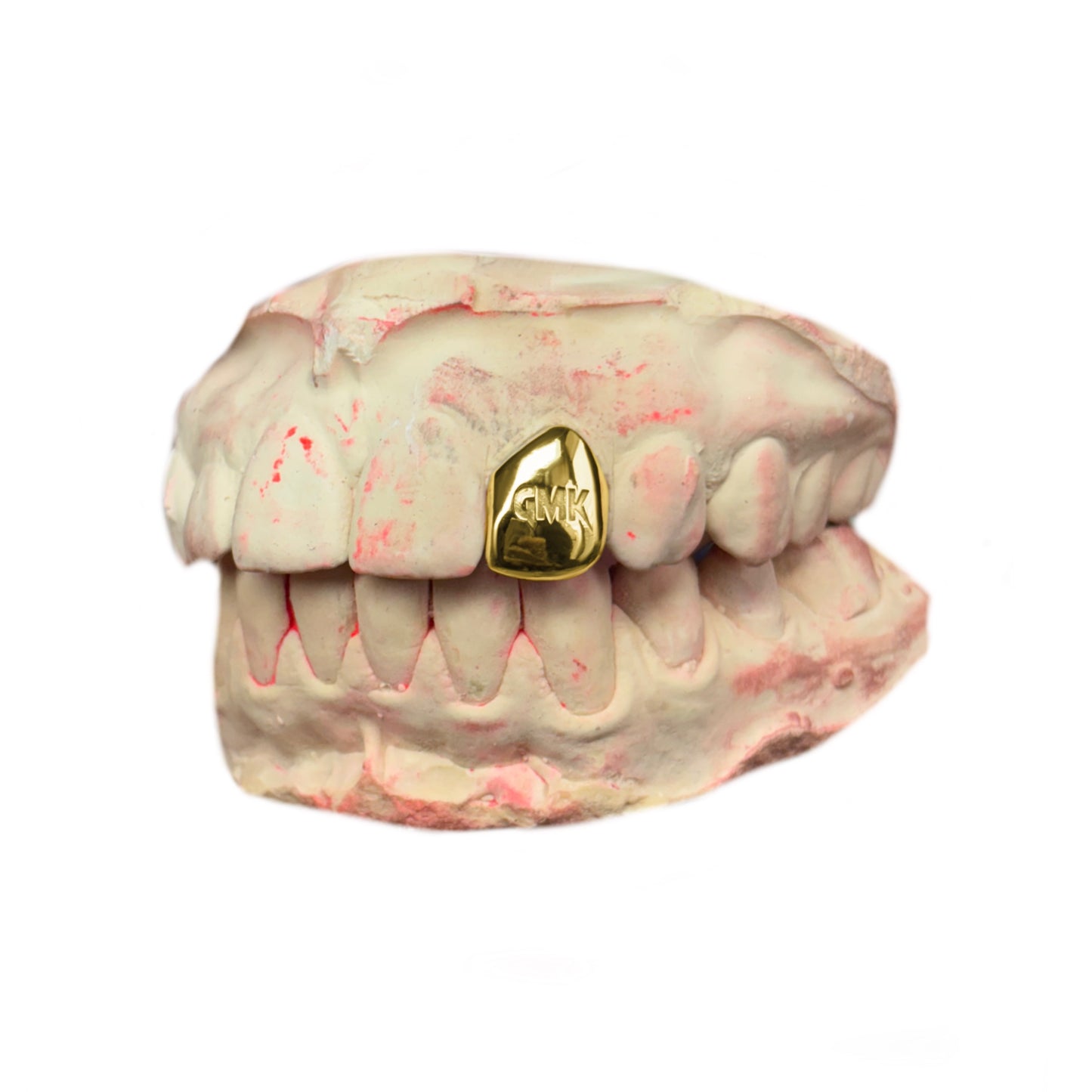 Grillz + gravure laser