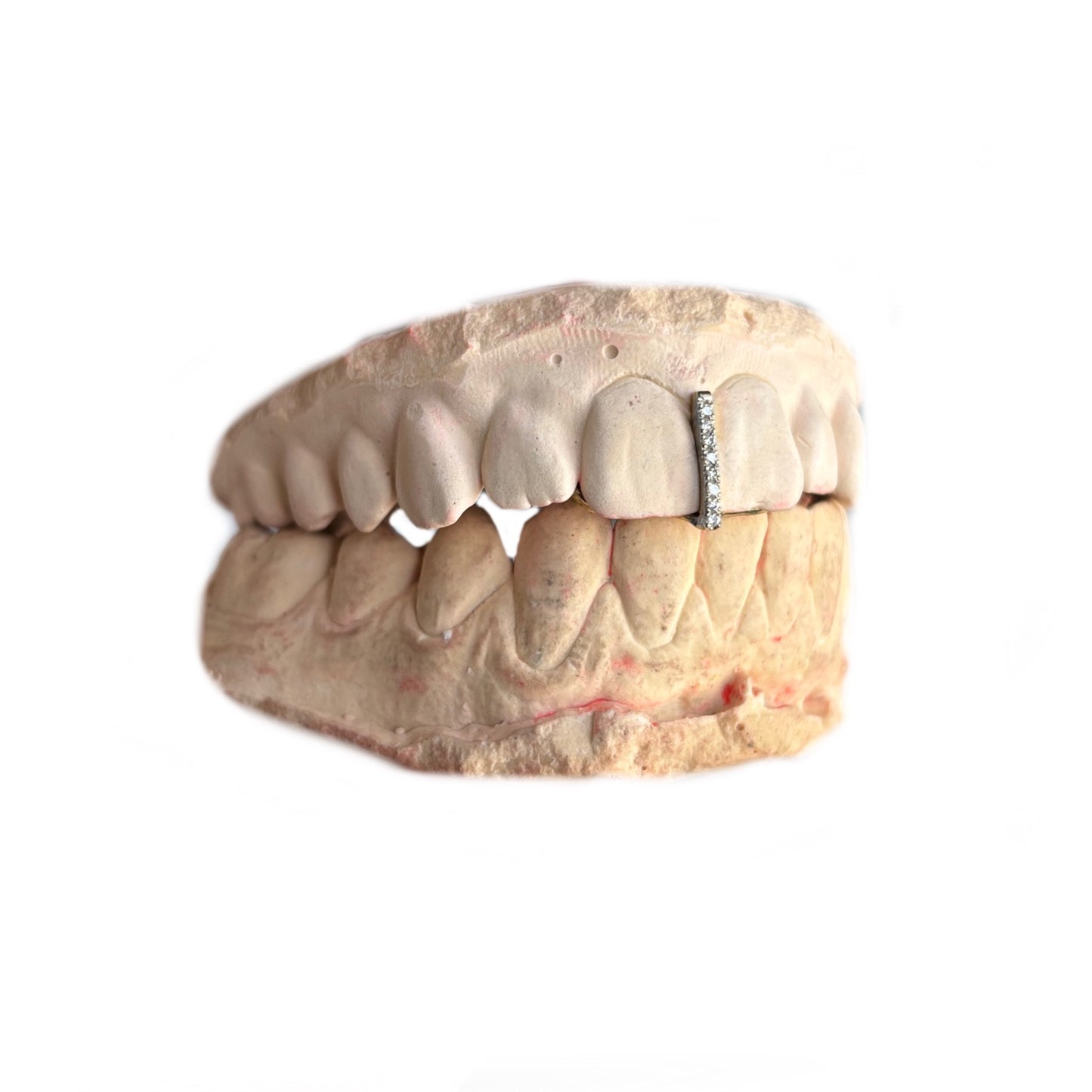 Interdentaire + pierre