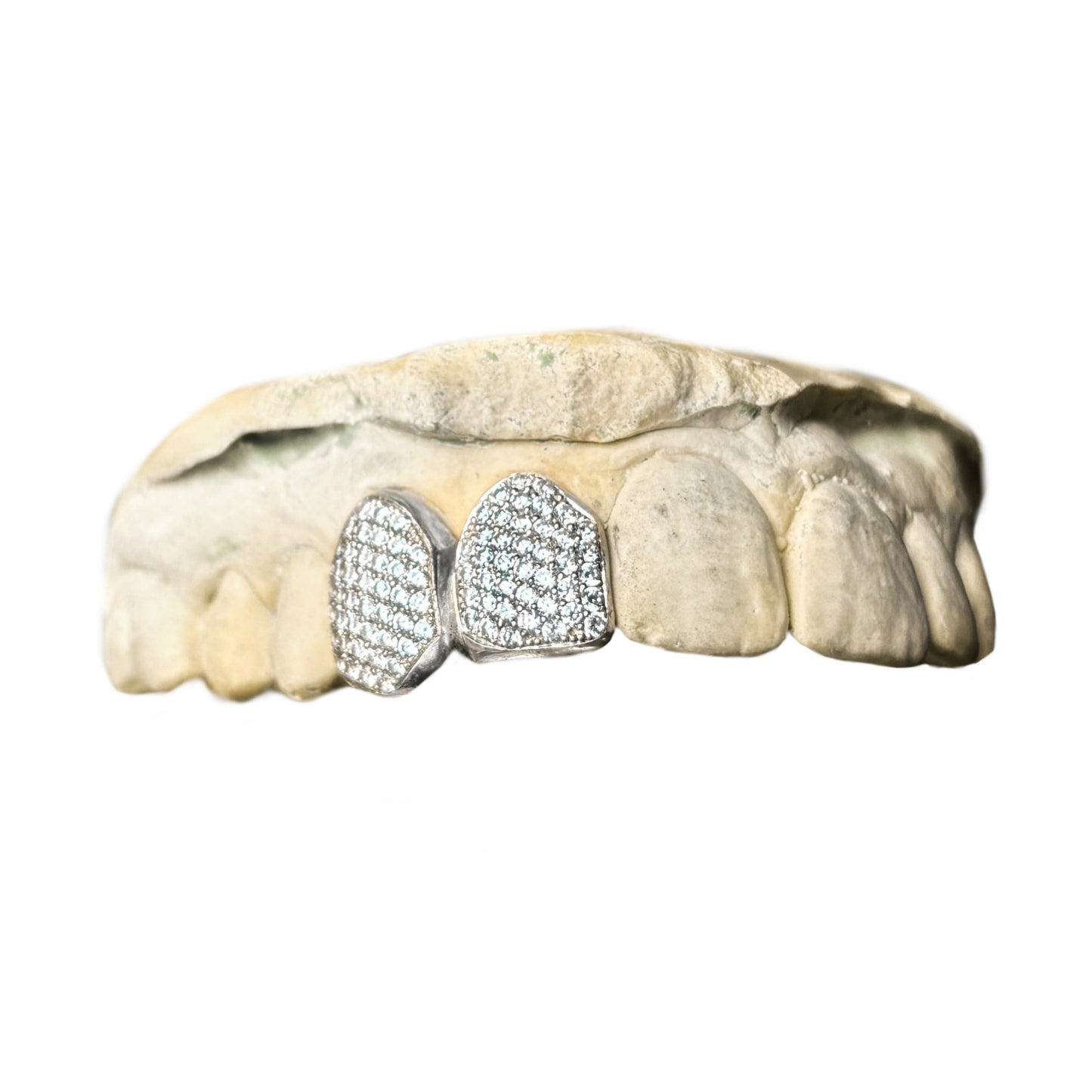 Full sertie (1 tooth)