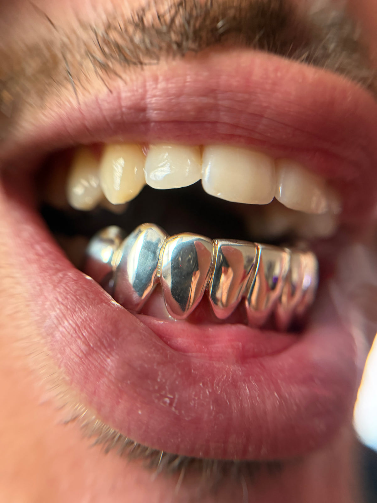 8 dents