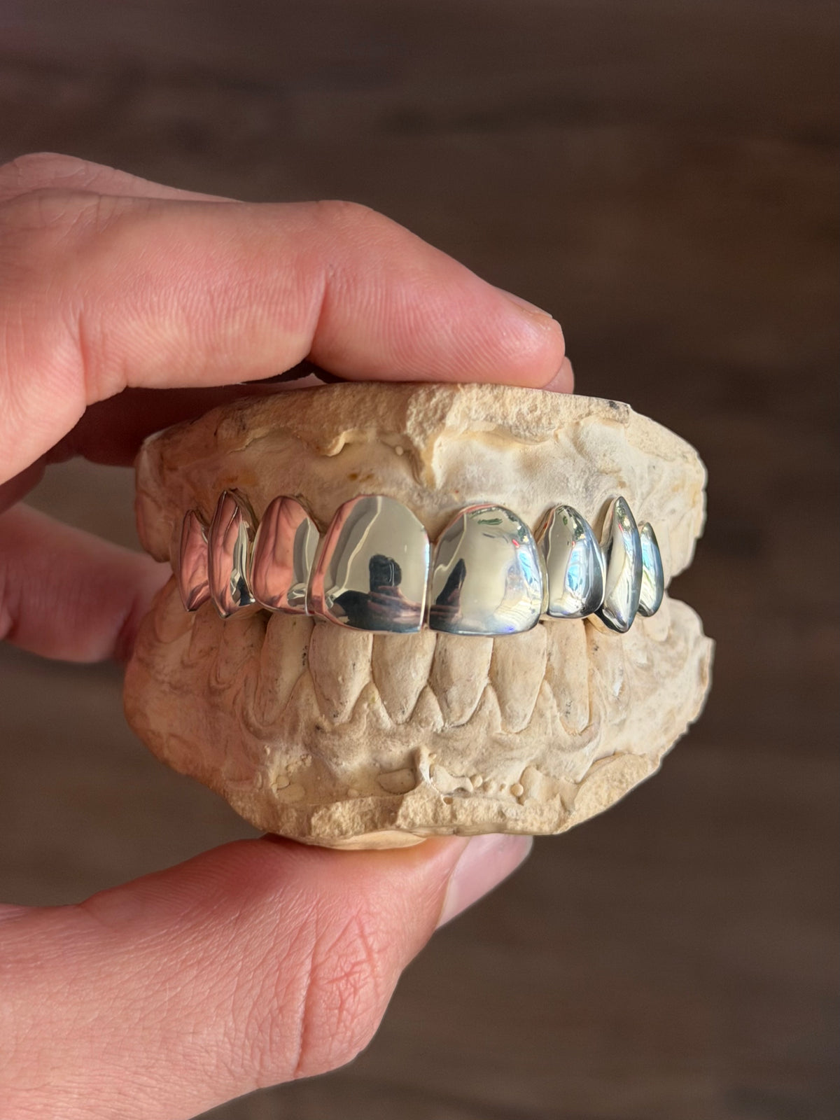 8 dents