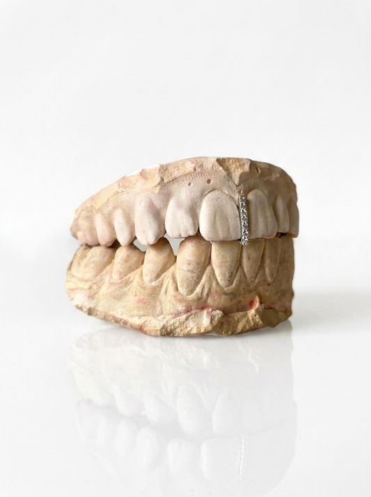 Interdental + stone