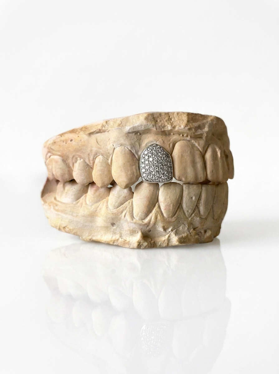 Full bezel (1 tooth)
