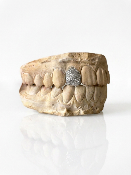 Full bezel (1 tooth)
