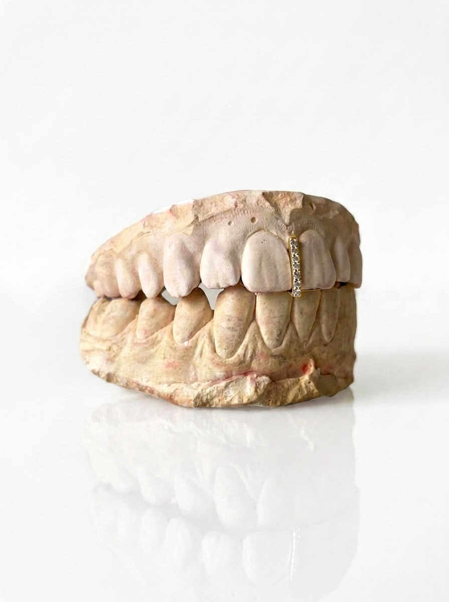 Interdental + stone