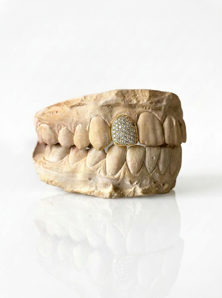 Full bezel (1 tooth)